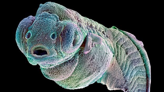 B0008608 Zebrafish embryo